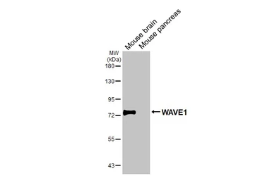 Anti-WAVE1 antibody [HL2901] used in Western Blot (WB). GTX640238