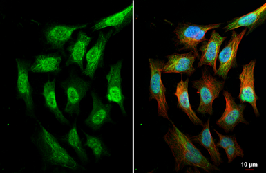 Anti-AKT antibody [HL2915] used in Immunocytochemistry/ Immunofluorescence (ICC/IF). GTX640258