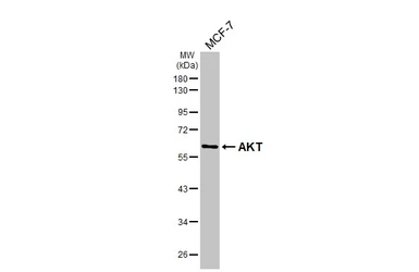 Anti-AKT antibody [HL2915] used in Western Blot (WB). GTX640258