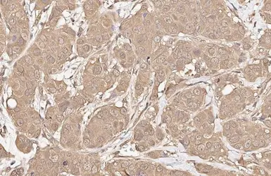 Anti-AKT antibody [HL2915] used in IHC (Paraffin sections) (IHC-P). GTX640258