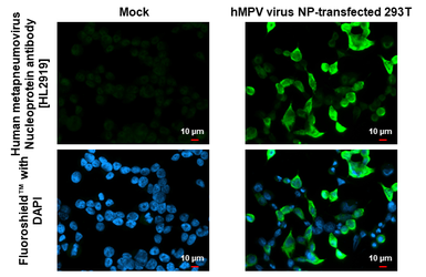 Anti-Human metapneumovirus Nucleoprotein antibody [HL2919] used in Immunocytochemistry/ Immunofluorescence (ICC/IF). GTX640262