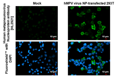 Anti-Human metapneumovirus Nucleoprotein antibody [HL2921] used in Immunocytochemistry/ Immunofluorescence (ICC/IF). GTX640264