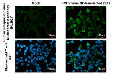 Anti-Human metapneumovirus Nucleoprotein antibody [HL2924] used in Immunocytochemistry/ Immunofluorescence (ICC/IF). GTX640267