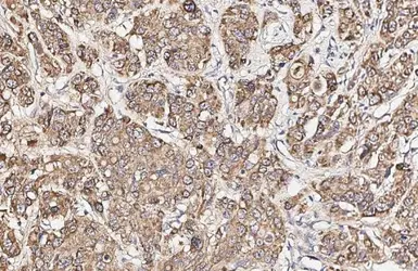 Anti-Dopamine Receptor D1 antibody [HL2927] used in IHC (Paraffin sections) (IHC-P). GTX640270