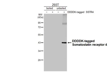 Anti-Somatostatin receptor 4 antibody [HL2933] used in Western Blot (WB). GTX640276