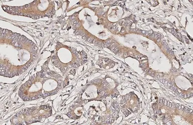 Anti-Somatostatin receptor 4 antibody [HL2933] used in IHC (Paraffin sections) (IHC-P). GTX640276