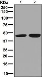 Anti-CABP1 antibody [EPR7916] used in Western Blot (WB). GTX64031