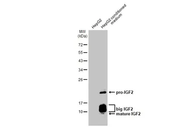 Anti-IGF2 antibody [HL2937] used in Western Blot (WB). GTX640321
