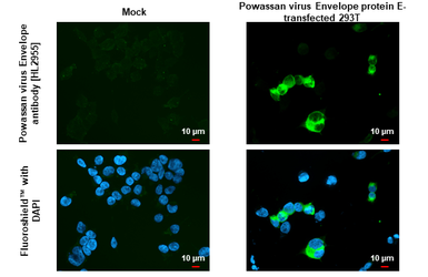 Anti-Powassan virus Envelope antibody [HL2955] used in Immunocytochemistry/ Immunofluorescence (ICC/IF). GTX640340