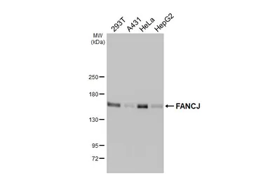 Anti-FANCJ antibody [HL2961] used in Western Blot (WB). GTX640348