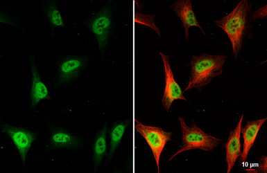 Anti-FANCJ antibody [HL2961] used in Immunocytochemistry/ Immunofluorescence (ICC/IF). GTX640348