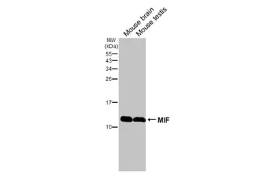 Anti-MIF antibody [HL2963] used in Western Blot (WB). GTX640350