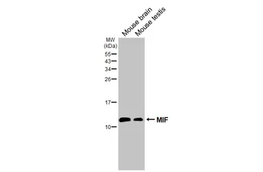 Anti-MIF antibody [HL2964] used in Western Blot (WB). GTX640351