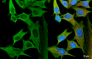 Anti-Flightless I antibody [HL2965] used in Immunocytochemistry/ Immunofluorescence (ICC/IF). GTX640352