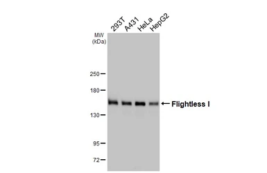 Anti-Flightless I antibody [HL2966] used in Western Blot (WB). GTX640353