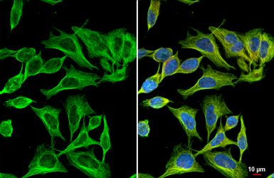 Anti-Flightless I antibody [HL2966] used in Immunocytochemistry/ Immunofluorescence (ICC/IF). GTX640353