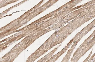 Anti-Flightless I antibody [HL2966] used in IHC (Paraffin sections) (IHC-P). GTX640353