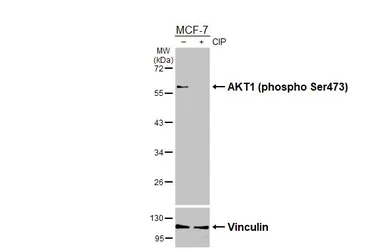 Anti-AKT1 (phospho Ser473) antibody [HL2972] used in Western Blot (WB). GTX640359