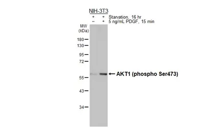 Anti-AKT1 (phospho Ser473) antibody [HL2972] used in Western Blot (WB). GTX640359