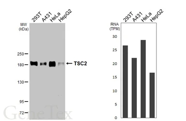 Anti-TSC2 antibody [HL2974] used in Western Blot (WB). GTX640361