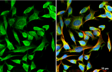 Anti-TSC2 antibody [HL2974] used in Immunocytochemistry/ Immunofluorescence (ICC/IF). GTX640361