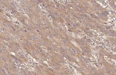 Anti-TSC2 antibody [HL2974] used in IHC (Paraffin sections) (IHC-P). GTX640361
