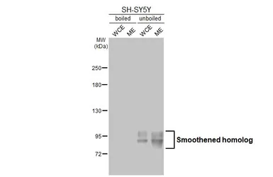 Anti-Smoothened homolog antibody [HL2975] used in Western Blot (WB). GTX640362
