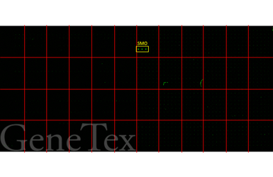 Anti-Smoothened homolog antibody [HL2975] used in Functional Assay (Functional Assay). GTX640362