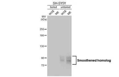 Anti-Smoothened homolog antibody [HL2976] used in Western Blot (WB). GTX640363