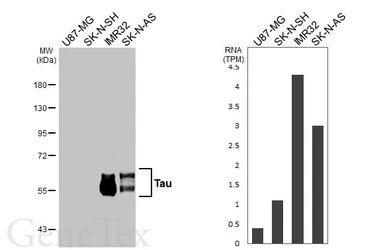 Anti-Tau antibody [HL2982] used in Western Blot (WB). GTX640369