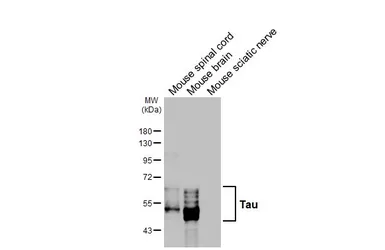Anti-Tau antibody [HL2982] used in Western Blot (WB). GTX640369