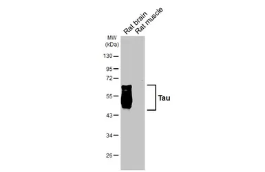 Anti-Tau antibody [HL2982] used in Western Blot (WB). GTX640369