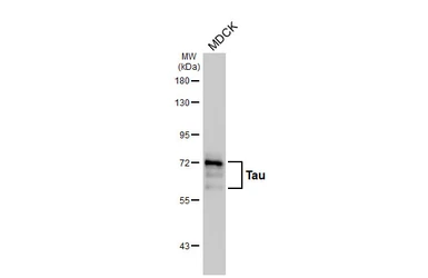Anti-Tau antibody [HL2982] used in Western Blot (WB). GTX640369