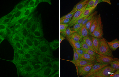 Anti-Tau antibody [HL2982] used in Immunocytochemistry/ Immunofluorescence (ICC/IF). GTX640369