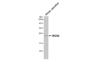 Anti-RGS2 antibody [HL2987] used in Western Blot (WB). GTX640397