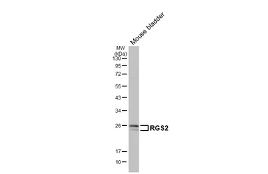 Anti-RGS2 antibody [HL2988] used in Western Blot (WB). GTX640398