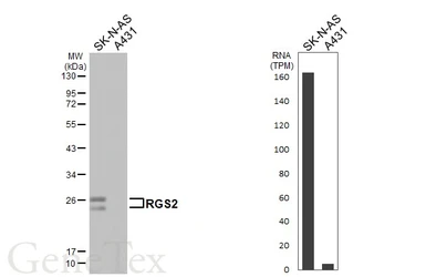 Anti-RGS2 antibody [HL2988] used in Western Blot (WB). GTX640398