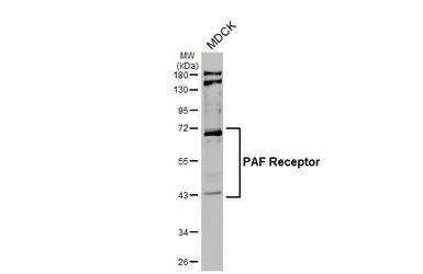Anti-PAF Receptor antibody [HL2998] used in Western Blot (WB). GTX640408