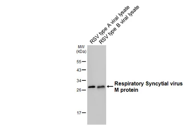 Anti-Respiratory Syncytial Virus M protein Antibody [HL3000] used in Western Blot (WB). GTX640410