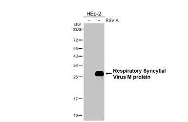 Anti-Respiratory Syncytial Virus M protein Antibody [HL3000] used in Western Blot (WB). GTX640410