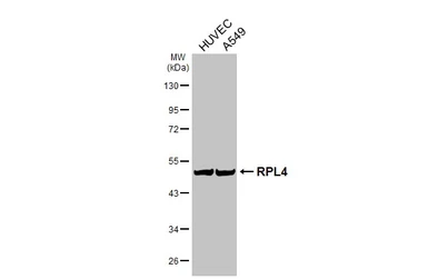 Anti-RPL4 antibody [HL3006] used in Western Blot (WB). GTX640419