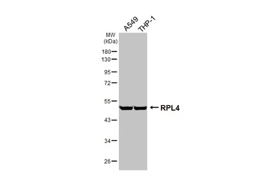 Anti-RPL4 antibody [HL3006] used in Western Blot (WB). GTX640419