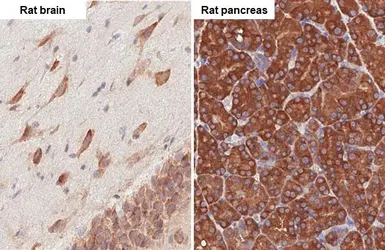 Anti-RPL4 antibody [HL3006] used in IHC (Paraffin sections) (IHC-P). GTX640419