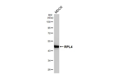 Anti-RPL4 antibody [HL3008] used in Western Blot (WB). GTX640421