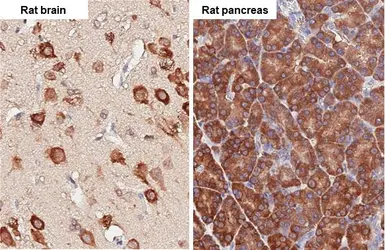 Anti-RPL4 antibody [HL3008] used in IHC (Paraffin sections) (IHC-P). GTX640421