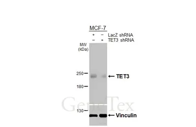 Anti-TET3 antibody [HL3009] used in Western Blot (WB). GTX640422