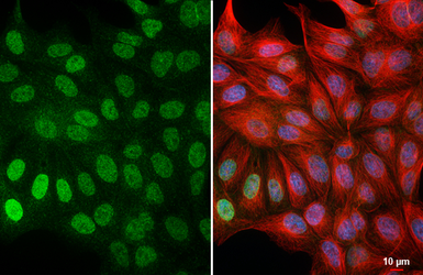 Anti-HIF1 alpha antibody [HL3011] used in Immunocytochemistry/ Immunofluorescence (ICC/IF). GTX640424