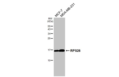 Anti-RPS26 antibody [HL3013] used in Western Blot (WB). GTX640426