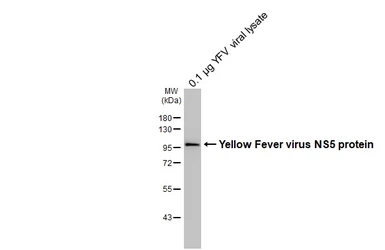 Anti-Yellow Fever virus NS5 protein antibody [HL3014] used in Western Blot (WB). GTX640427