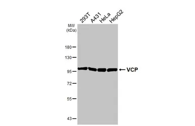 Anti-VCP antibody [HL3018] used in Western Blot (WB). GTX640431